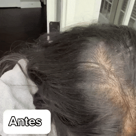 Shampoo Cubre canas Dos Lunas "El Original"