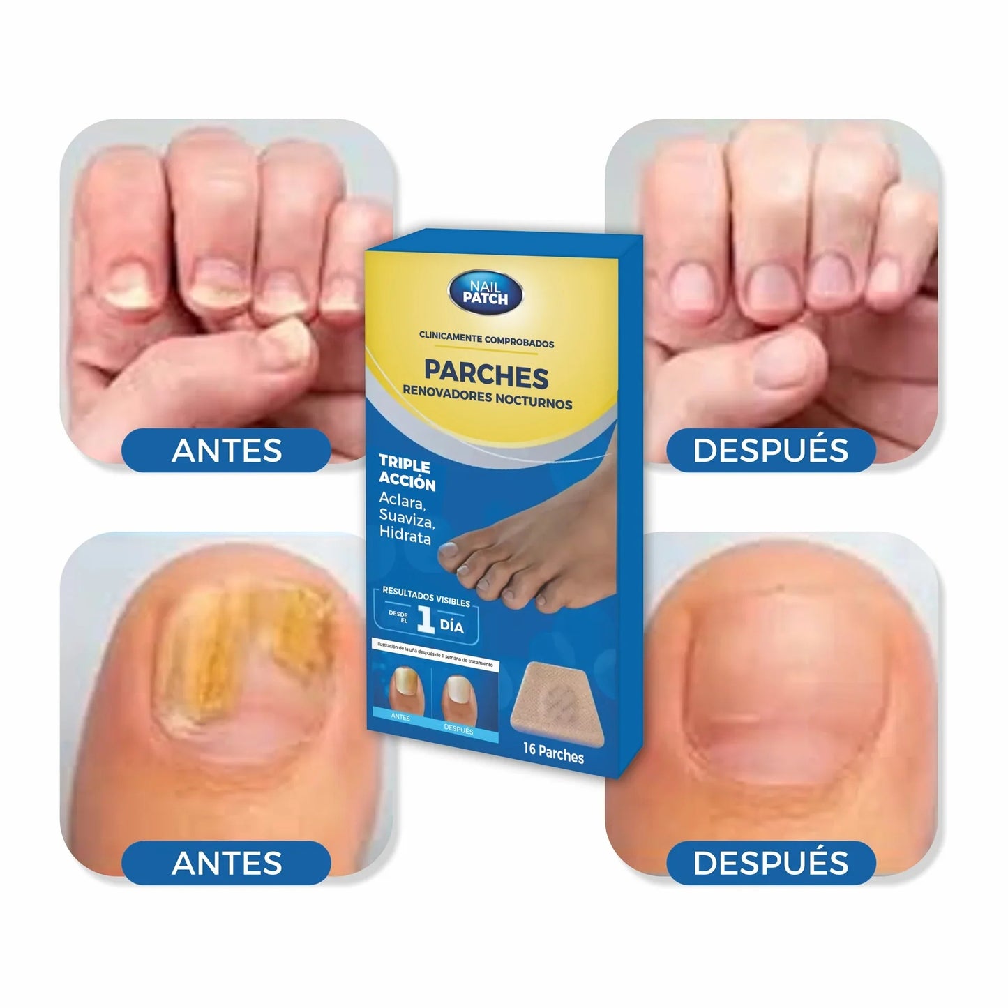3X1 Parche Elimina Hongos en Uñas Pack 3 Cajas de 16 unidades
