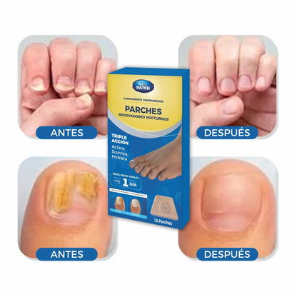 3X1 Parche Elimina Hongos en Uñas Pack 3 Cajas de 16 unidades
